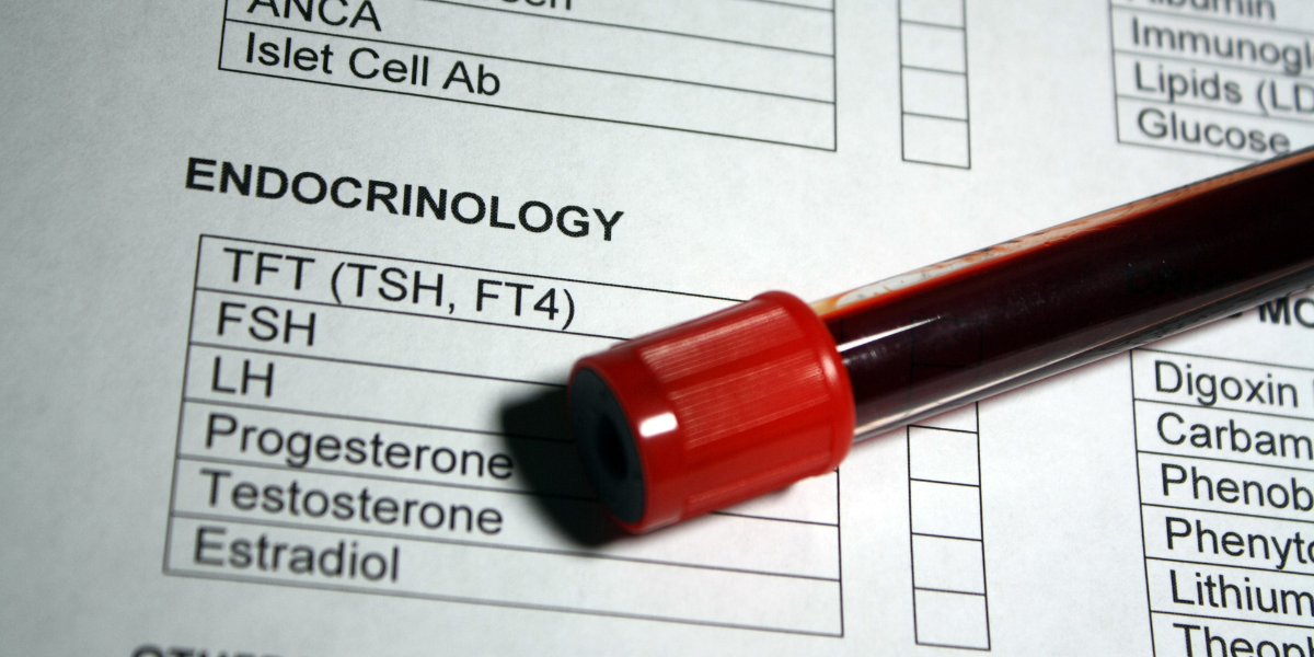 endocrinologie la copii